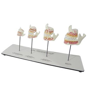 หุ่นจำลองพัฒนาการของฟัน 4 ระยะ (Human Dentition Development Model)