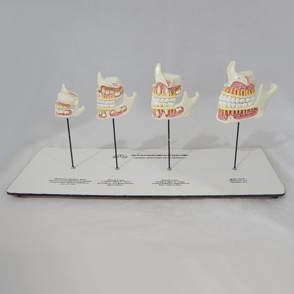 หุ่นจำลองพัฒนาการของฟัน 4 ระยะ (Human Dentition Development Model) - Image 2