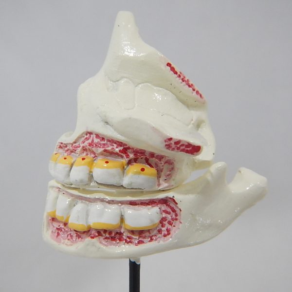 หุ่นจำลองพัฒนาการของฟัน 4 ระยะ (Human Dentition Development Model) - Image 3