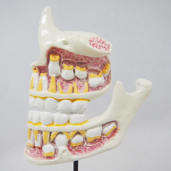หุ่นจำลองพัฒนาการของฟัน 4 ระยะ (Human Dentition Development Model) - Image 4