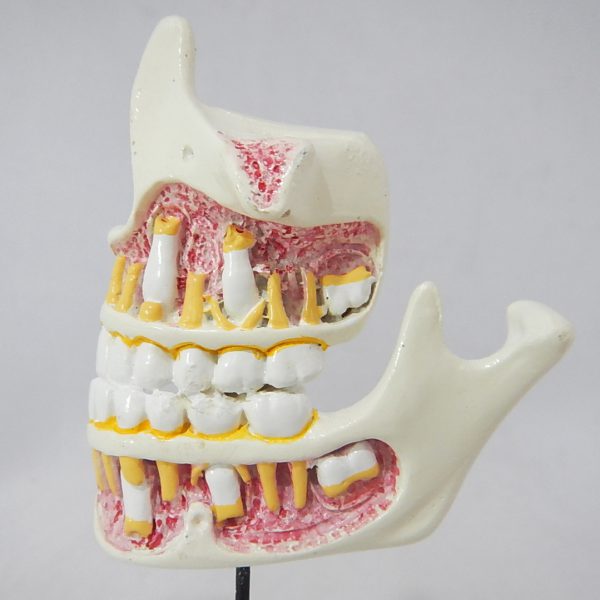 หุ่นจำลองพัฒนาการของฟัน 4 ระยะ (Human Dentition Development Model) - Image 5