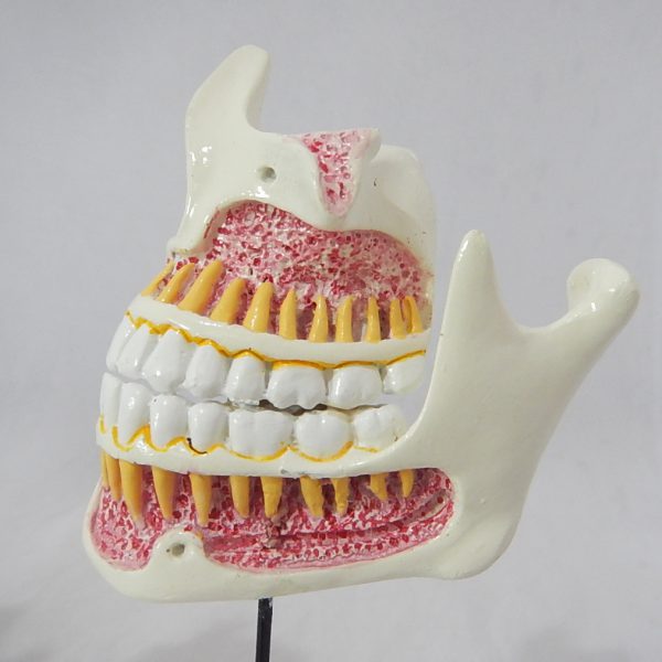 หุ่นจำลองพัฒนาการของฟัน 4 ระยะ (Human Dentition Development Model) - Image 6