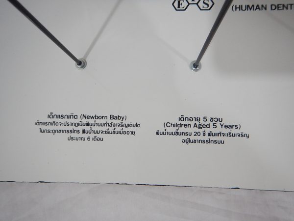 หุ่นจำลองพัฒนาการของฟัน 4 ระยะ (Human Dentition Development Model) - Image 7