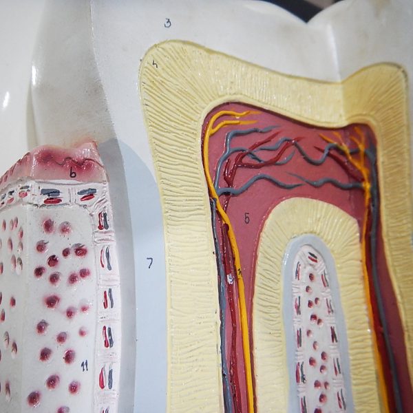 แบบจำลองโครงสร้างฟัน (Tooth Structure Model) - Image 4