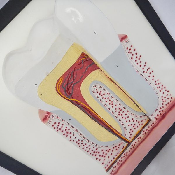 แบบจำลองโครงสร้างฟัน (Tooth Structure Model) - Image 5